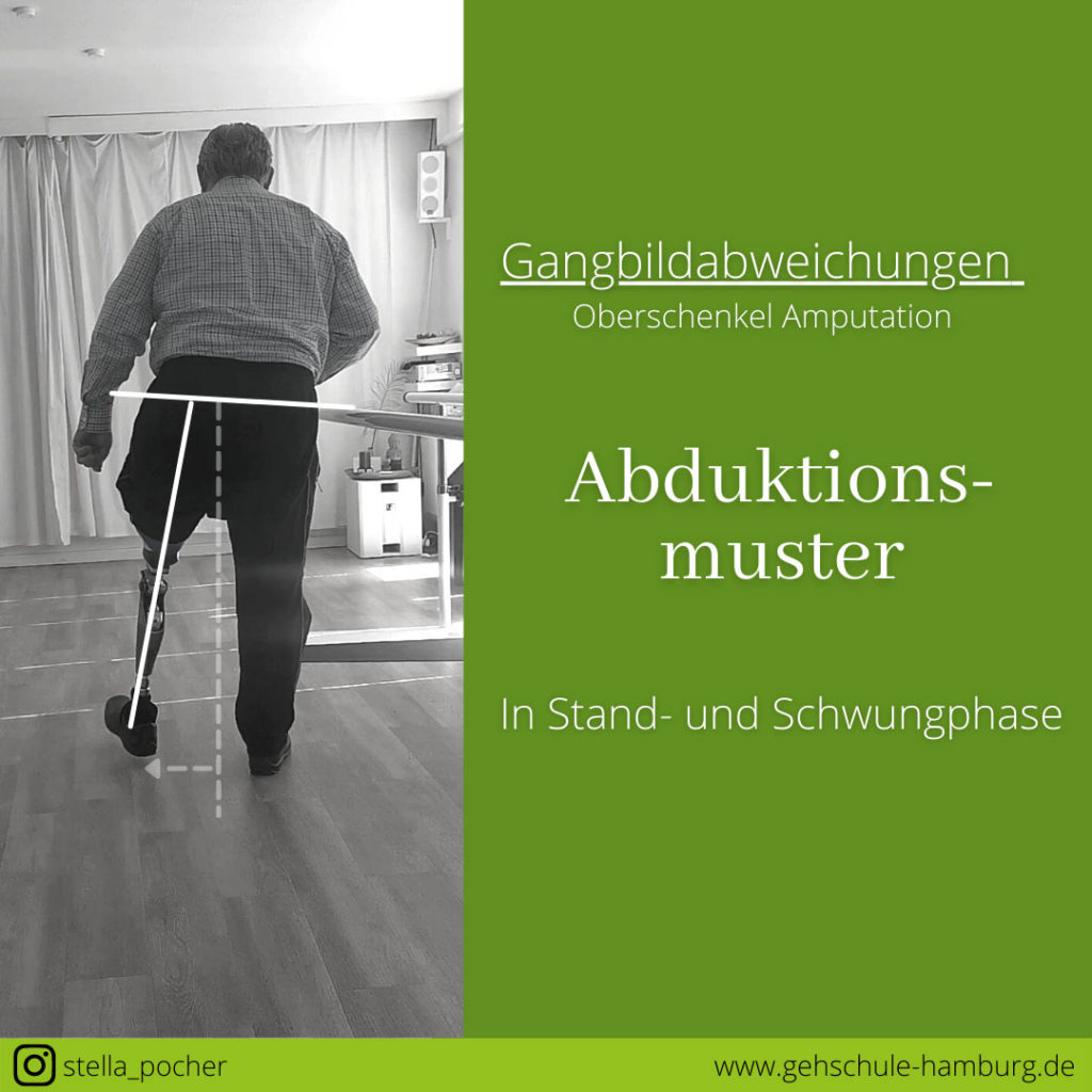 Abduktionsmuster Gehschule Hamburg